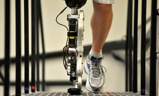 患者安裝河南假肢時需要注意事項,如何區(qū)分假肢(圖1) 患者安裝河南假肢時需要注意事項,如何區(qū)分假肢(圖1)