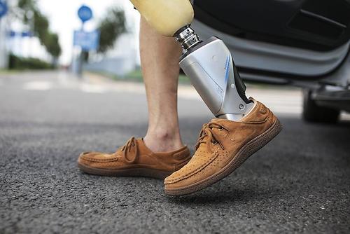 假肢價(jià)格力康假肢廠家制造出來產(chǎn)品性能優(yōu)勢(圖1)